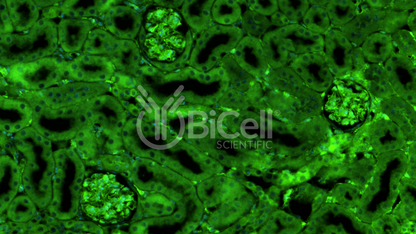ARHGDIA (GDIA1 or NPHS8) Antibody
