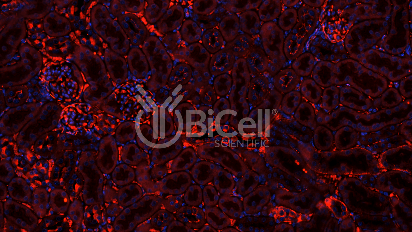 Claudin-1 (CLDN1) Antibody - FFPE Validated
