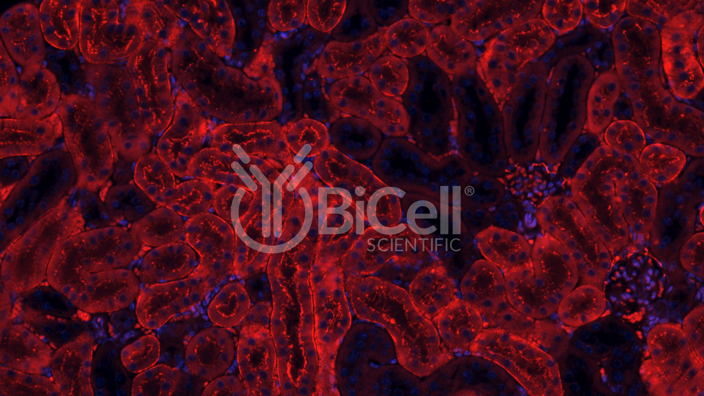 Claudin-2 (CLDN2) Antibody - FFPE Validated