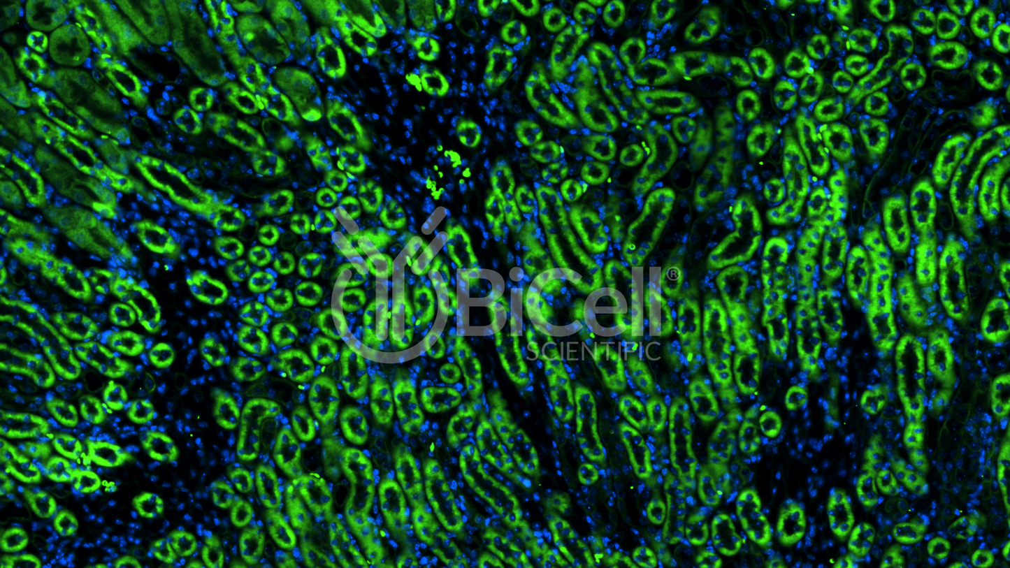 CXCR1 (CD128 or CD181 or IL8RA) Antibody