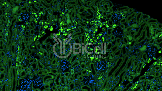 CXCR2 (CD182 or IL8RB) Antibody - FFPE Validated