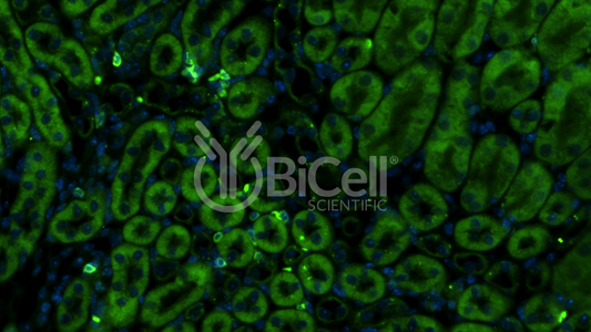 CXCR3 (CD183) Antibody - FFPE Validated