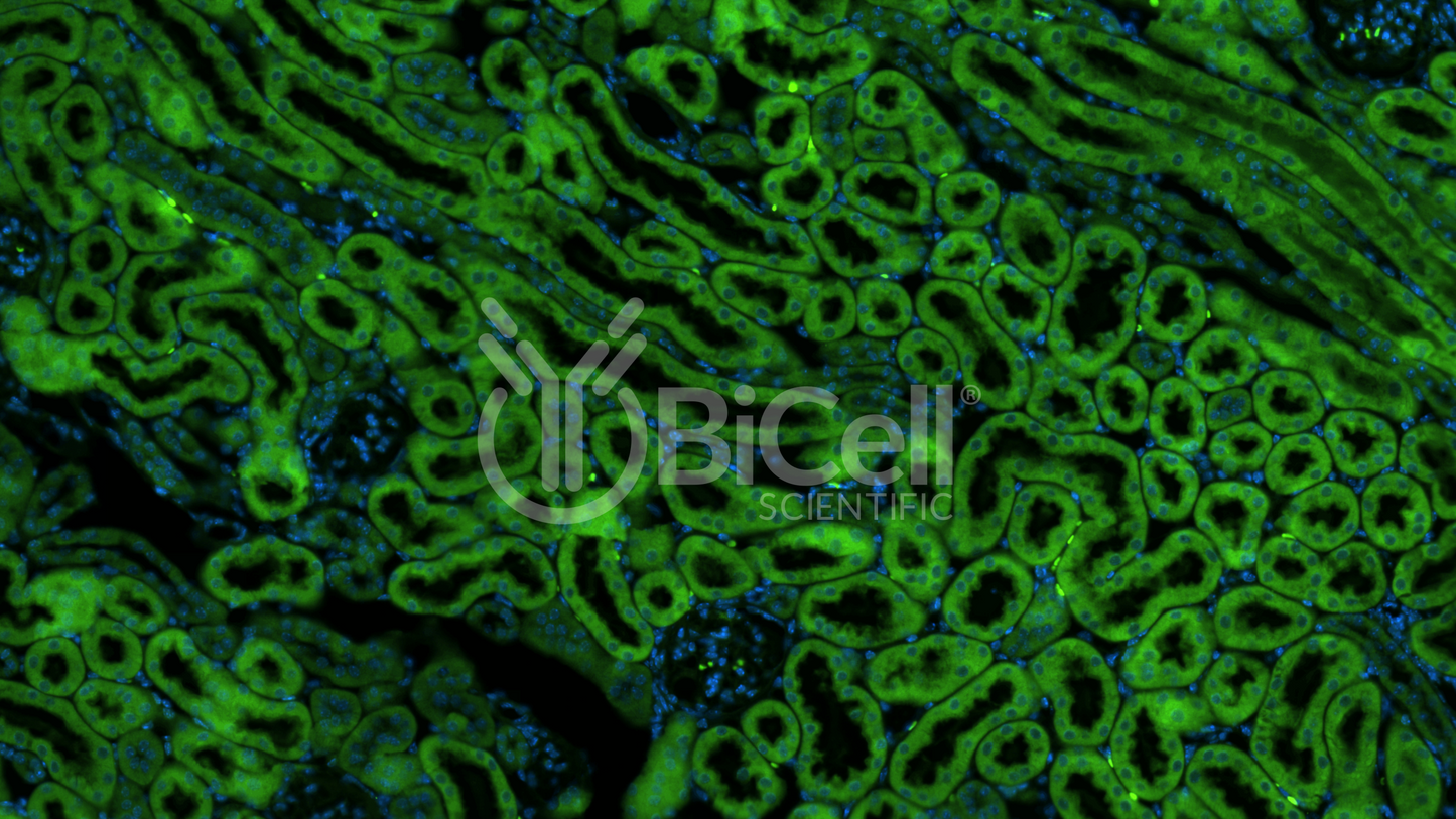 CXCR4 (CD184) Antibody - FFPE Validated