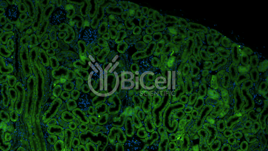 CXCR5 (CD185) Antibody