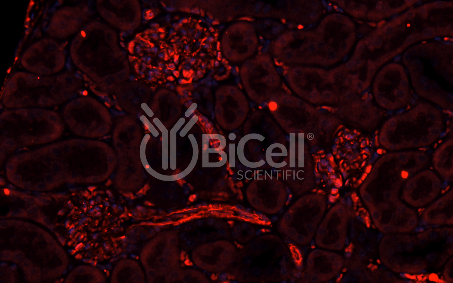 Integrin alpha-1 (ITGA1 or CD49a) Antibody - FFPE Validated