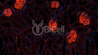 Integrin alpha-3 (ITGA3 or CD49c) Antibody - FFPE Validated