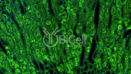 Integrin alpha-D (ITGAD or CD11d) Antibody - Western Blot Validated