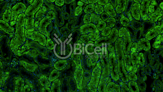Integrin alpha-E (ITGAE or CD103) Antibody - Western Blot Validated