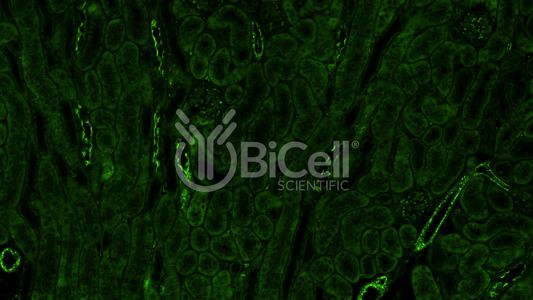 Integrin alpha-L (ITGAL or CD11a) Antibody - Western Blot Validated