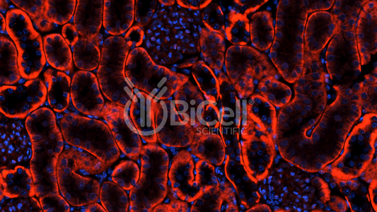 Integrin alpha-V (ITGAV or CD51) Antibody - Western Blot Validated