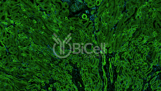 Myosin IE (MYO1E or FSGS6) Antibody - FFPE Validated