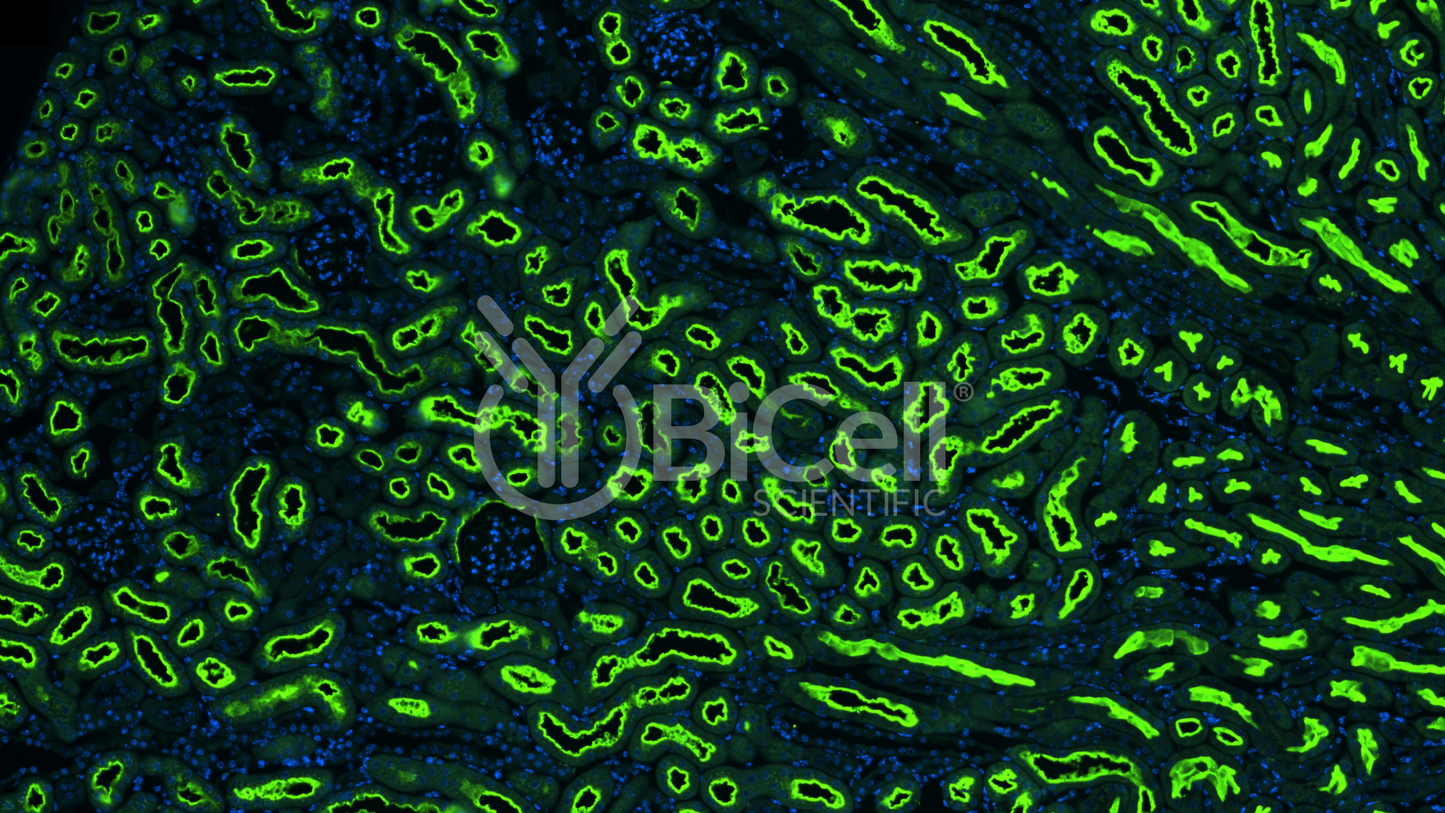 NPT2a (SLC34a1) Antibody - FFPE Validated