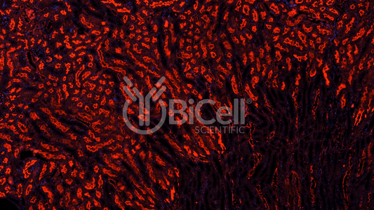 PTEN Antibody - FFPE Validated