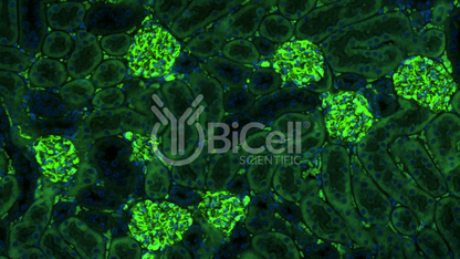 Vimentin (VIM) Antibody - FFPE Validated