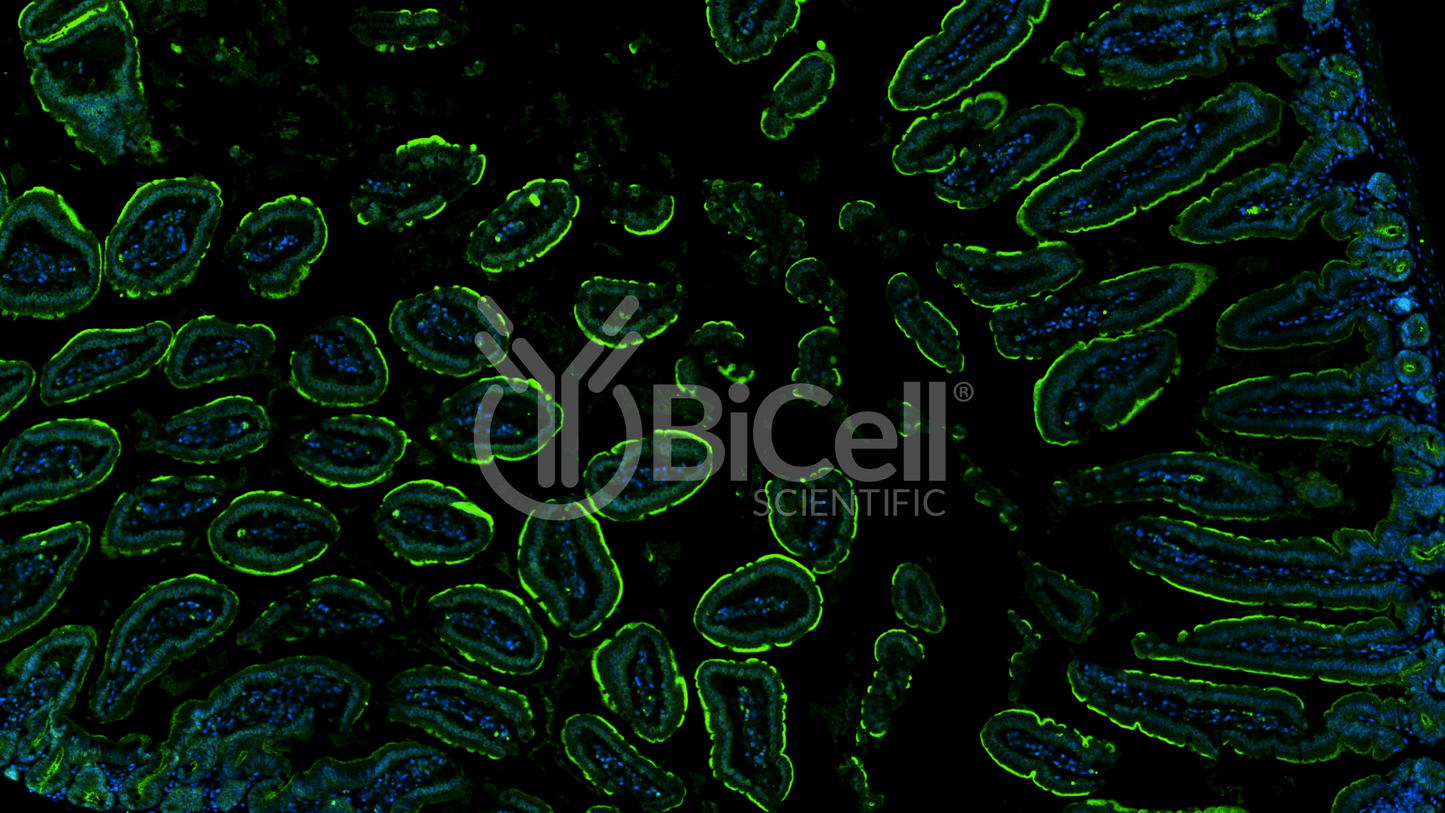 CCR6 (CD196) Antibody