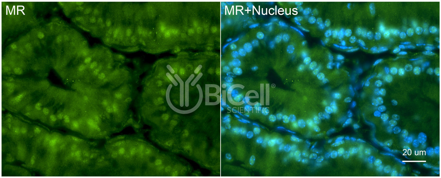 MR (NR3C2) Antibody - FFPE Validated