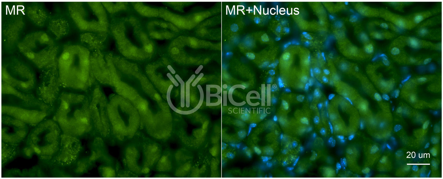 MR (NR3C2) Antibody - Western Blot Validated