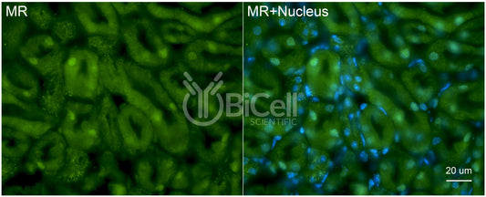 MR (NR3C2) Antibody - Western Blot Validated