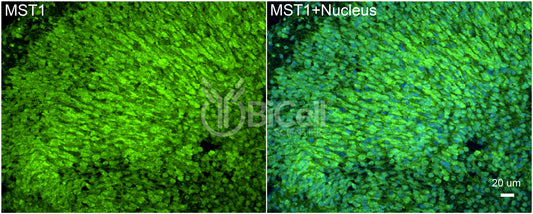 STK4 (MST1) Antibody - FFPE Validated