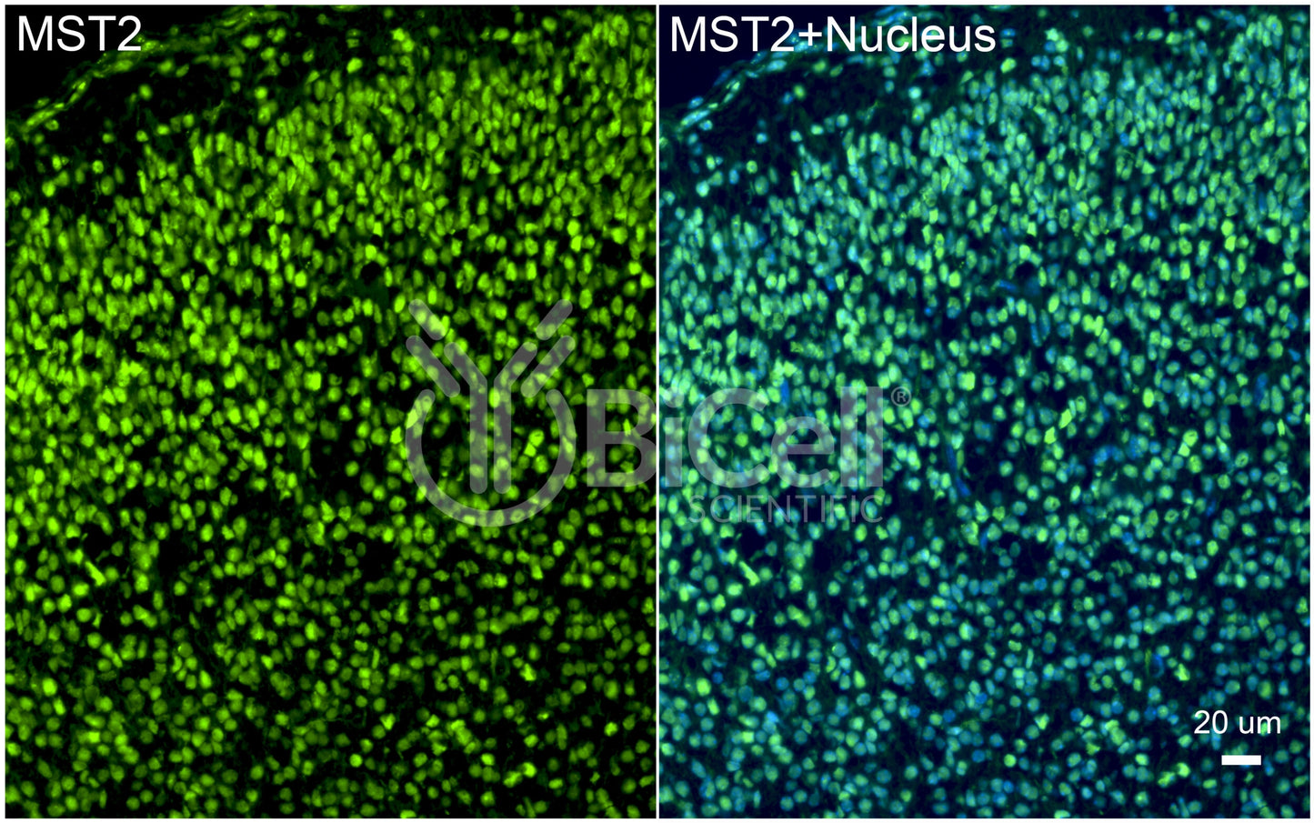 STK3 (MST2) Antibody
