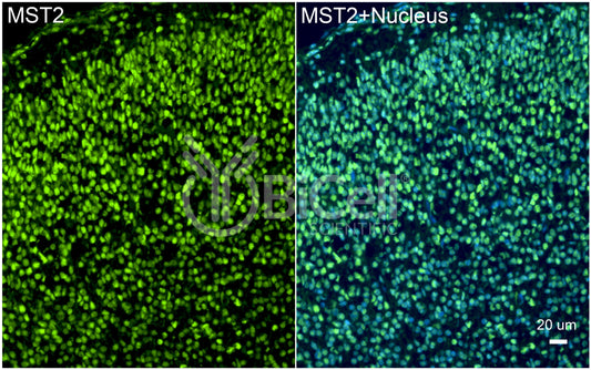 STK3 (MST2) Antibody