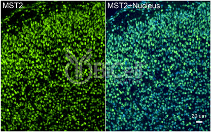 STK3 (MST2) Antibody - FFPE Validated