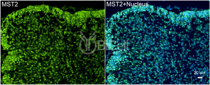 STK3 (MST2) Antibody - Western Blot Validated