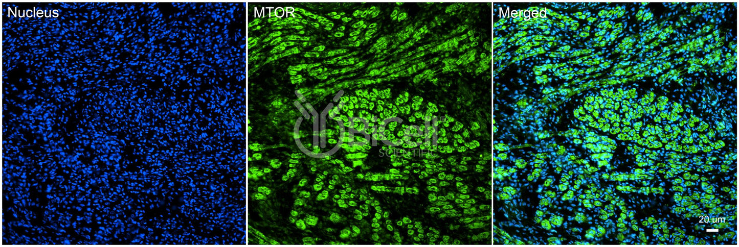 MTOR Antibody
