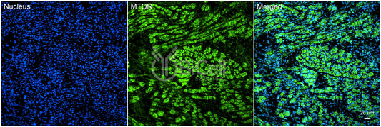 MTOR Antibody