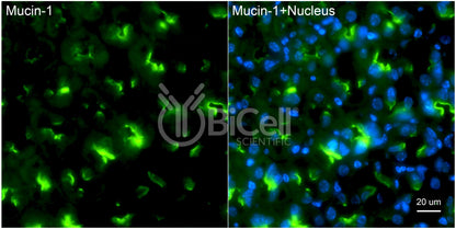Mucin-1 (MUC1 or CD227) Antibody - Western Blot Validated
