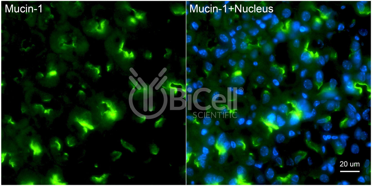 Mucin-1 (MUC1 or CD227) Antibody - FFPE Validated