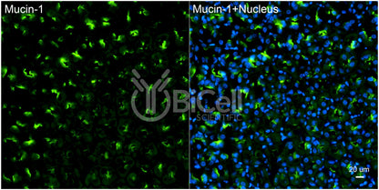 Mucin-1 (MUC1 or CD227) Antibody - Western Blot Validated