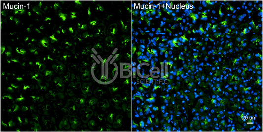 Mucin-1 (MUC1 or CD227) Antibody - Western Blot Validated