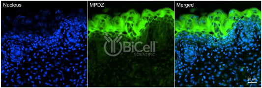 MPDZ (MUPP1) Antibody - Western Blot Validated