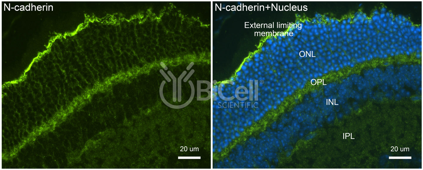N-cadherin (Cdh2 or CD325) Antibody - Western Blot Validated