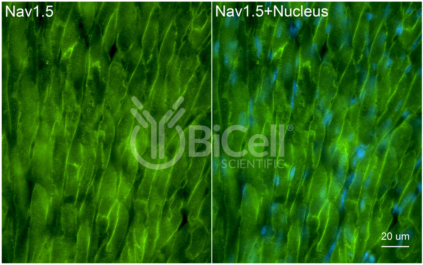 SCN5A (Nav1.5) Antibody
