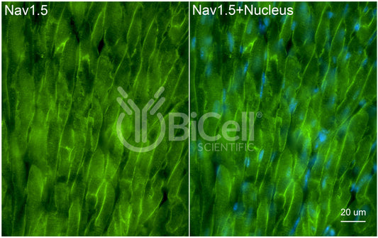 SCN5A (Nav1.5) Antibody