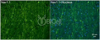 SCN1A (Nav1.1) Antibody - Western Blot Validated