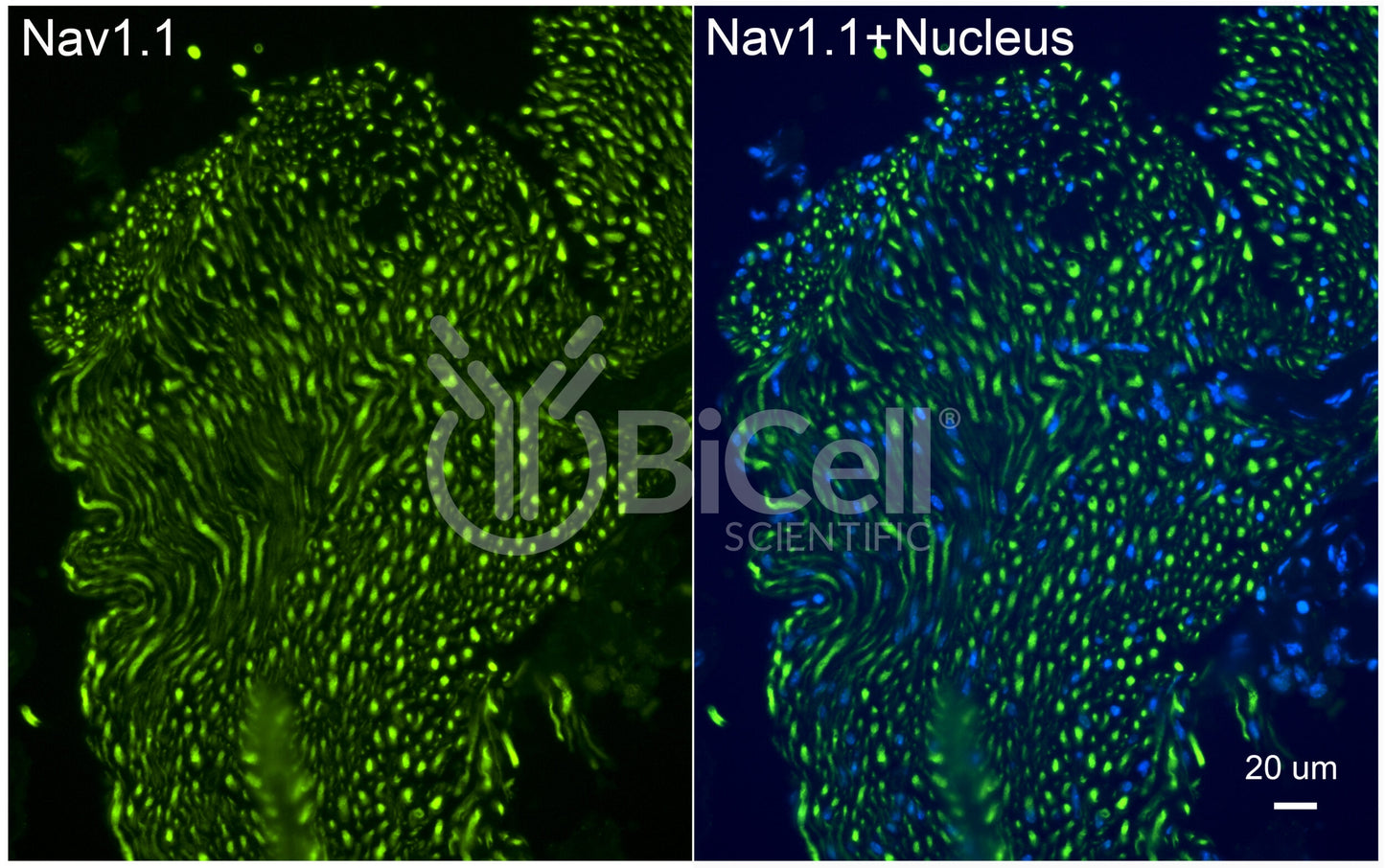 SCN1A (Nav1.1) Antibody