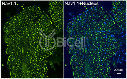 SCN1A (Nav1.1) Antibody