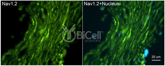 SCN2A (Nav1.2) Antibody - FFPE Validated