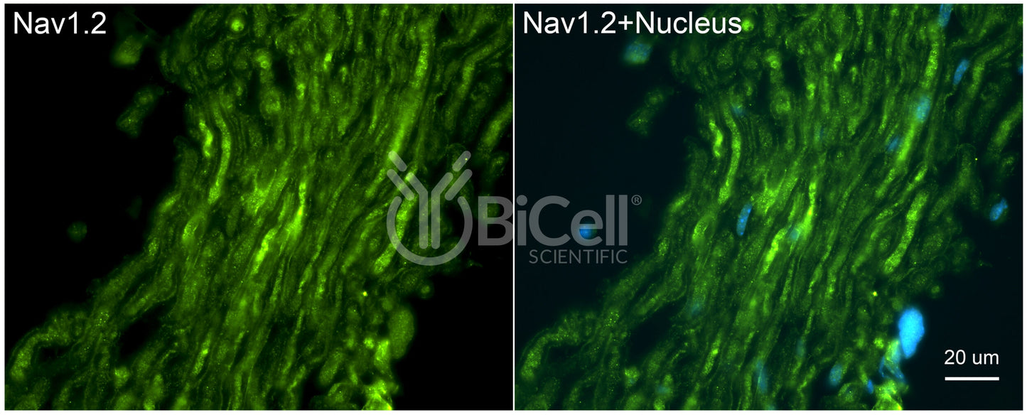 SCN2A (Nav1.2) Antibody