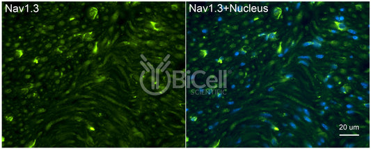 SCN3A (Nav1.3) Antibody - Western Blot Validated