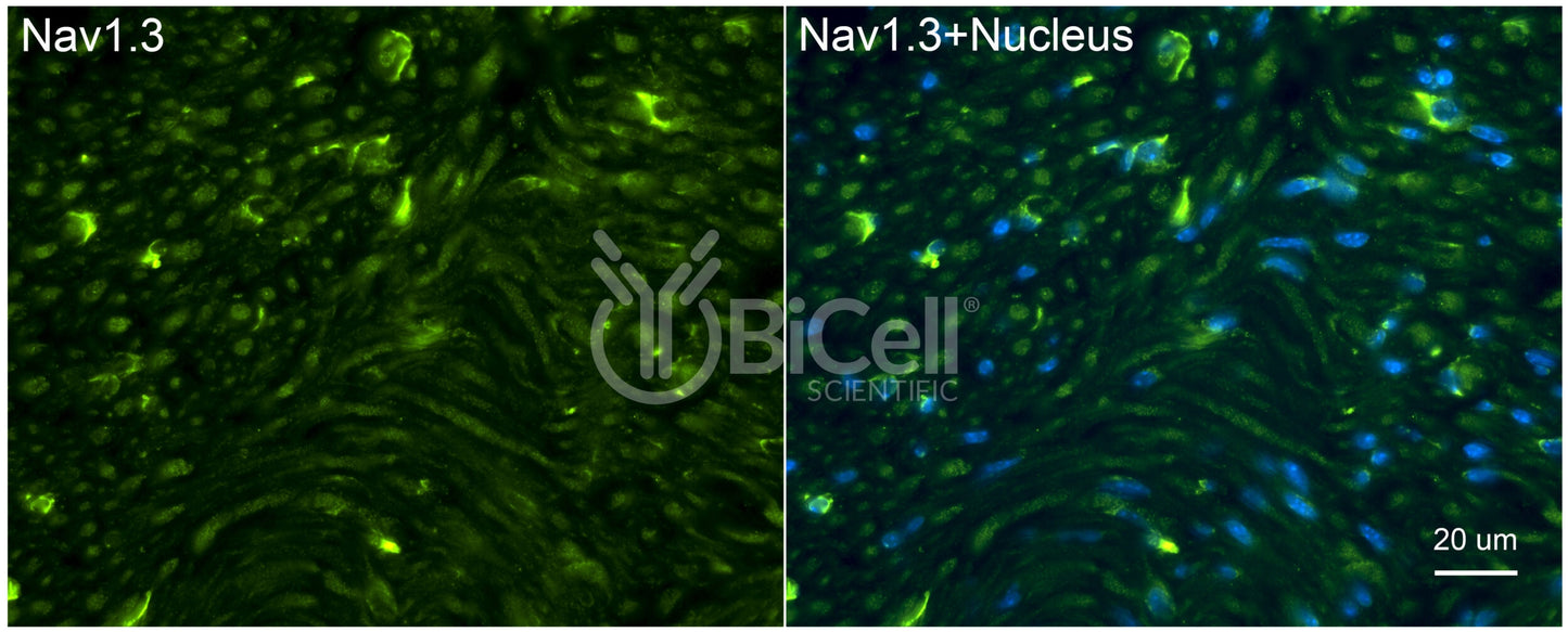 SCN3A (Nav1.3) Antibody - FFPE Validated