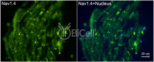 SCN4A (Nav1.4) Antibody - FFPE Validated