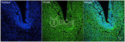 NCAM (CD56) Antibody - Western Blot Validated