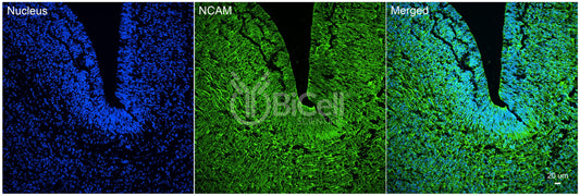 NCAM (CD56) Antibody - Western Blot Validated
