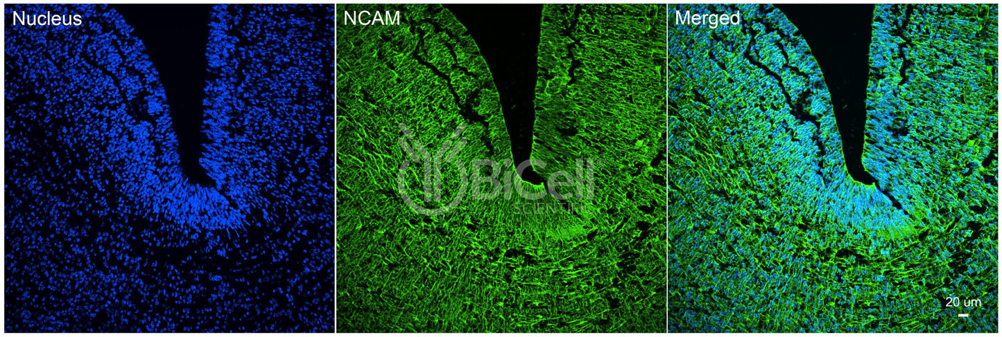 NCAM (CD56) Antibody