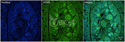 NCAM (CD56) Antibody - FFPE Validated