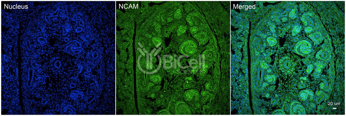 NCAM (CD56) Antibody